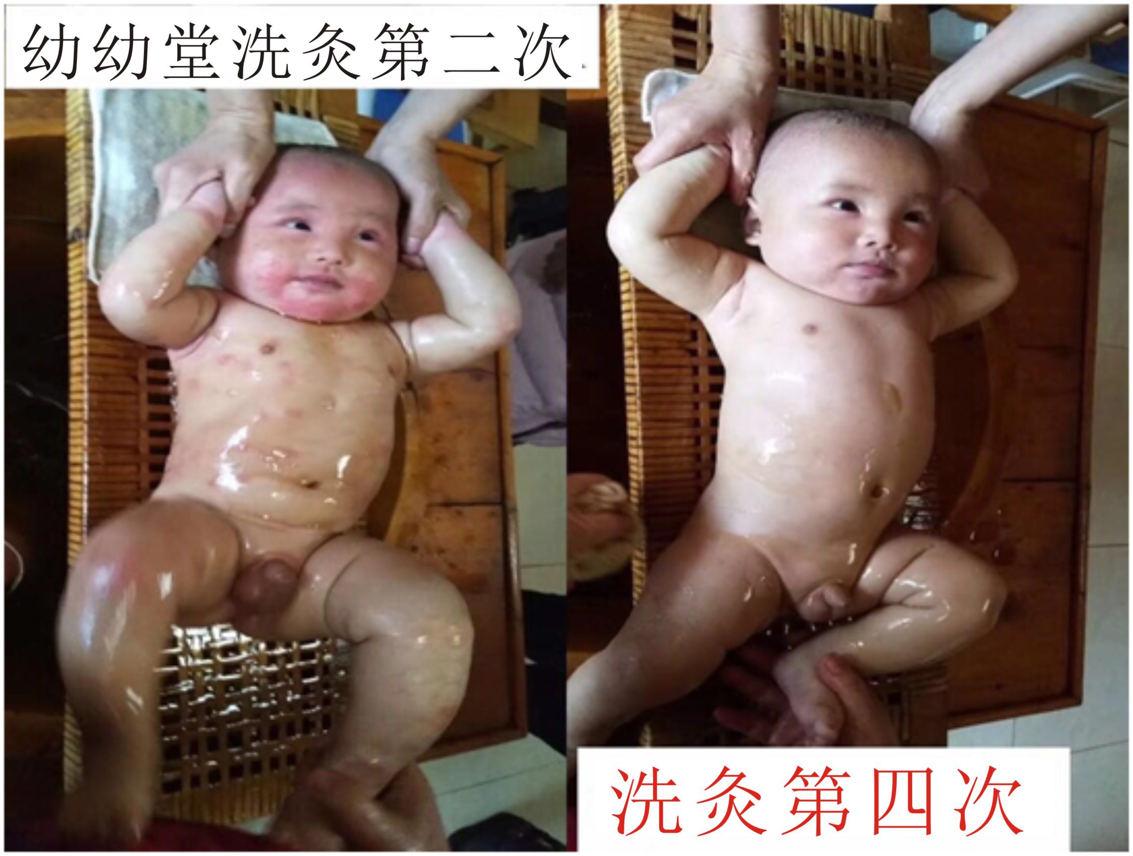 幼幼堂小儿洗灸